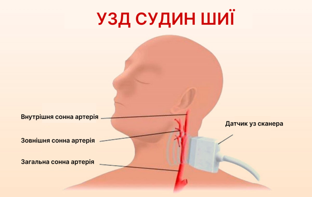 Як часто повторювати УЗД?